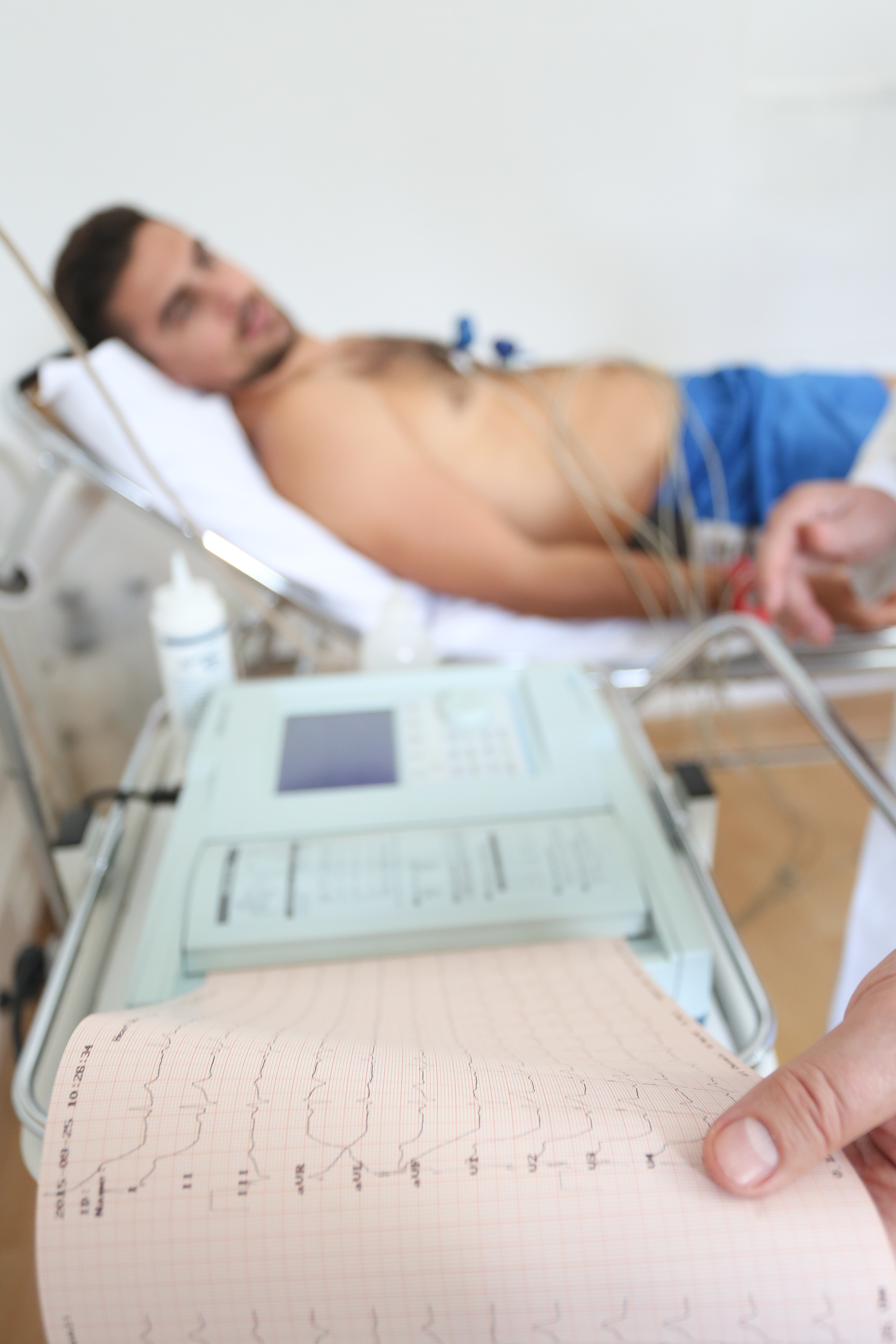 ECG
